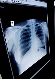 ashtead-hospital-image
