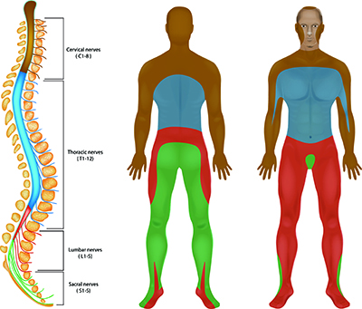 Leg Pain or Sciatica